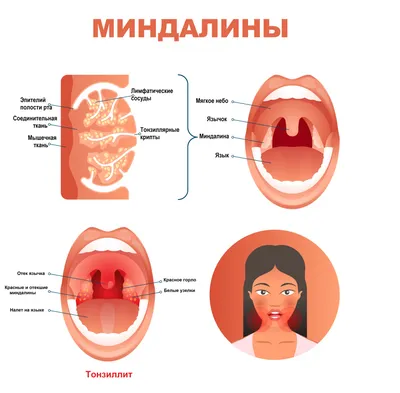 Заболевания горла и гортани: симптомы, признаки и лечение