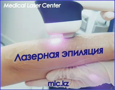 Мужская лазерная эпиляция - клиника лазерной косметологии в Москве