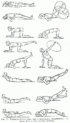 Лечебная гимнастика, как обязательная часть лечебного комплекса при  переломах позвоночника по методу В. В. Гориневской и Е.Ф.Древинг