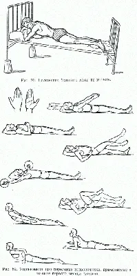 Упражнения при остеохондрозе поясничного отдела позвоночника: гимнастика  для спины, комплекс, физкультура
