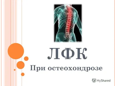 Лечение остеохондроза в Москве: цены на консультацию врача в медицинском  центре «ТН-КЛИНИКА»