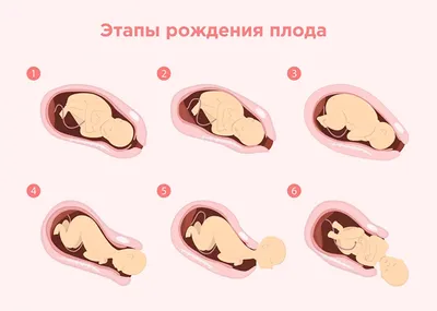 Ведение нормальных родов. (Модуль 5) - презентация онлайн