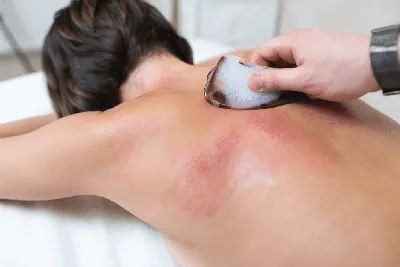 Лечебный массаж спины в СПб. Медицинский массаж мышц спины позвоночника.