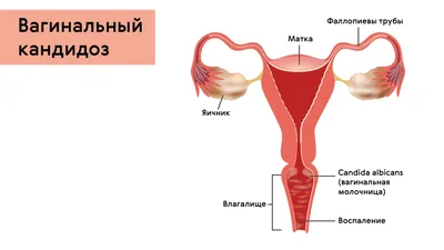 Можно ли заниматься сексом при молочнице? | doc.ua