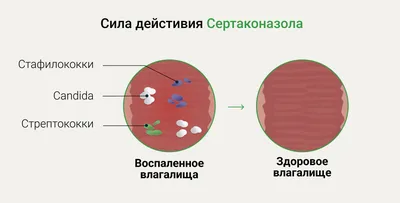 Молочница: что это такое и когда бежать к врачу | Зачатие,Беременность и  Роды. Блог | Дзен