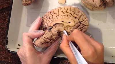 Мозг — это мышца: четыре правила для развития памяти и скорости мышления -  Inc. Russia