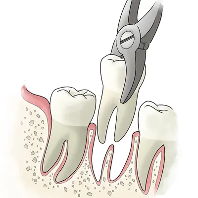 Как называется врач, который протезирует зубы? | Стоматология Улыбка