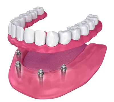 Счет Зубов В Стоматологии Фото – Telegraph