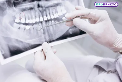 Удаление зубов в Калининграде по доступной цене - Ортодонт в Калининграде в  стоматологии Ортодонт-ЛЮКС