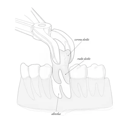 Анатомия зубов: 54 аннотированные иллюстрации | e-Anatomy