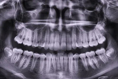 Как выбрать стоматологию для имплантации зубов: подробная инструкция и  советы стоматологов