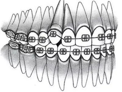 Рентген зубов в стоматологии Doctor Smile в Курске