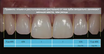 Зубной штифт – что это, виды, плюсы и минусы | Блог | Стоматология «Дент  Тайм»