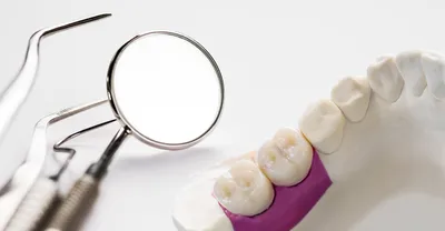 Восстановление отсутствующих зубов при помощи имплантации и протезирование  всех зубов керамическими коронками