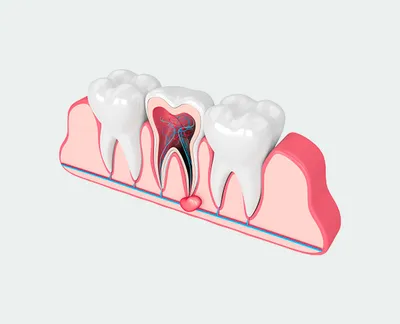 Нездоровье зубов может повлиять на работу сердца? Все самое важное о зубах  | Блог фонда «Нужна помощь»