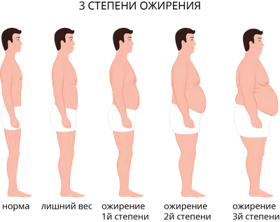 Ожирение: причины, методы диагностики, лечение