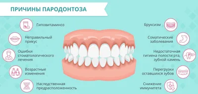 Пародонтоз - симптомы, лечение и профилактика заболевания