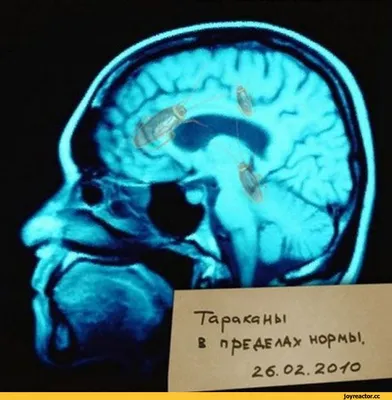 Я: * РАЗГОВАРИВАЮ С НОВЫМ ЧЕЛОВЕКОМ И ПЫТАЮСЬ ВЕСТИ СЕБЯ НОРМАЛЬНО* ТАРАКАНЫ  В МОЕЙ ГОЛОВЕ: / Приколы для даунов :: разное / картинки, гифки, прикольные  комиксы, интересные статьи по теме.