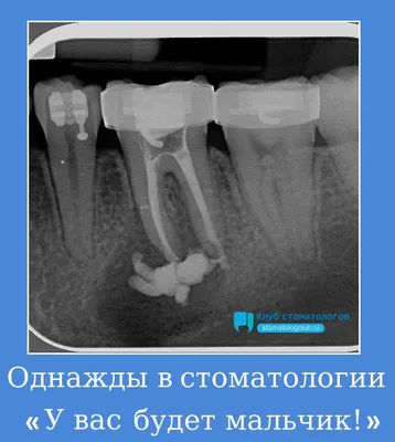Flash_Print Кружка прикол для стоматолога с надписью чашка подарок врачу с  принтом с рисунком зубной мем
