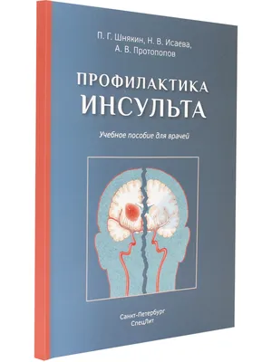 Профилактика инсульта. Врач — о способах защиты для людей из группы риска —  «Свет маяков»