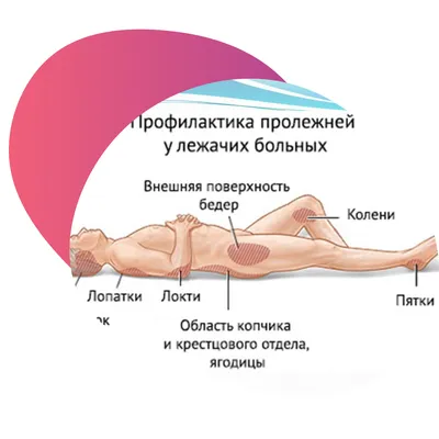 Пролежни | Пикабу