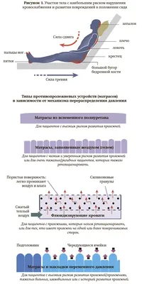 Как лечить пролежни в домашних условиях? | медицинские товары и медтехника  в магазине Ортосалон