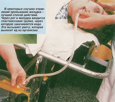 Тренажер зондирования и промывания желудка человека | feba.ru