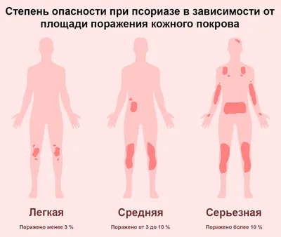 ПСОРИАЗ - причины, подробно о лечении, признаки и симптомы псориаза -  YouTube