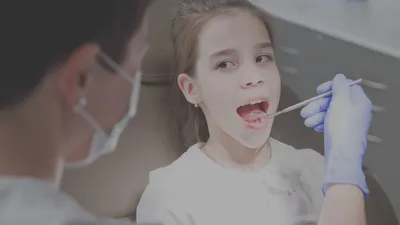 Реминерализующая терапия - Белая Радуга. Клиника семейной профилактической  стоматологии в Москве