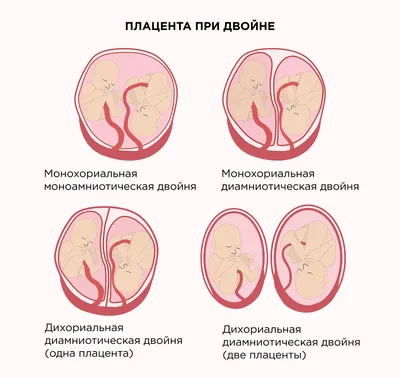 Беременность по неделям | Клиника ведения беременности в Пятигорске