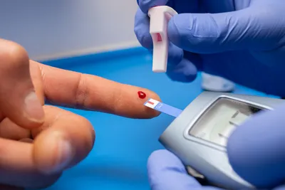 Патологии ногтей как осложнения сахарного диабета | Виталина Ленина | Дзен