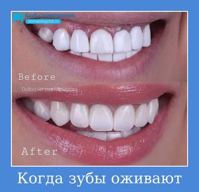 Зуб и скейлер | Юмор дантиста, Стоматология, Стоматологический юмор