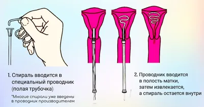 Гипнотическая спираль, психоделическая свирль Иллюстрация вектора -  иллюстрации насчитывающей психоделический, динамически: 104550256