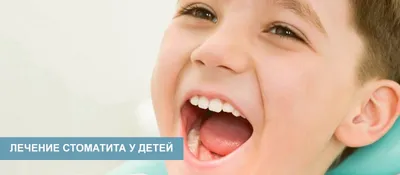 Стоматит - лечение стоматита у детей - Статьи - Стомо.рф -  стоматологический портал Красноярска
