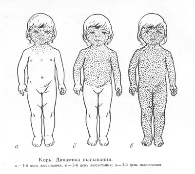 Неделя профилактики заболеваний органов дыхания (в честь Всемирного дня  борьбы с пневмонией) с 06 по 12 ноября 2023 года - Официальный сайт  администрации города Березники