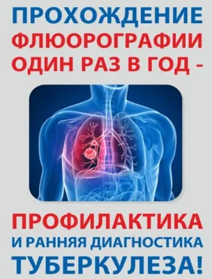 Туберкулез и рак легких, как отличить туберкулез от рака лешкого |  Patient-mt.ru