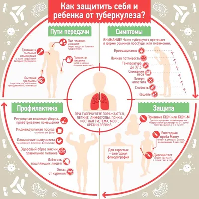 Туберкулез - УЗ «Гродненская университетская клиника»