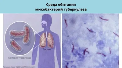 Центр общественного здоровья и медицинской профилактики » Что такое  туберкулез?