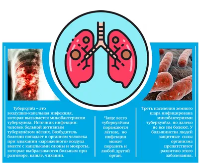 Один больной может заразить туберкулезом 10-15 человек | КГБУЗ  «Владивостокская поликлиника № 1»