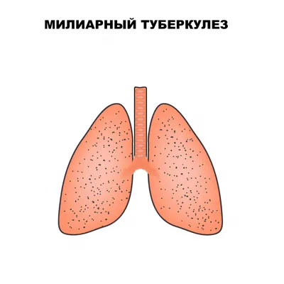 Туберкулез и психосоматика | ОГАУЗ Детская городская больница №2