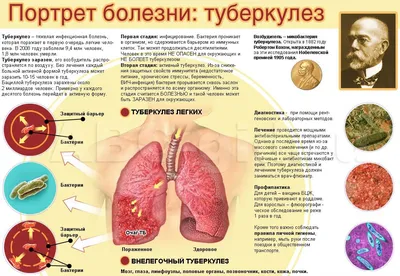 Туберкулез - Новости - Роспотребнадзор - Государственные организации  информируют - Официальный сайт администрации городского округа Нижняя Салда