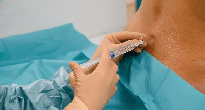 Какие уколы делают перед операцией: рассказывают хирурги