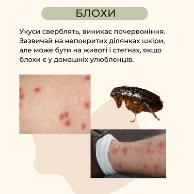 Укусы насекомых - Консультация Дерматолога Онлайн iDerma