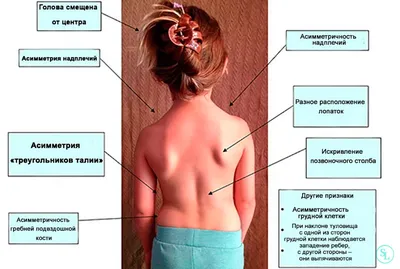 Упражнения для поясничного отдела позвоночника