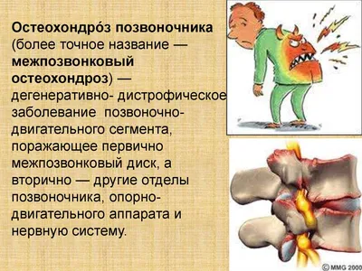 Йога для спины и позвоночника: упражнения для начинающих в домашних  условиях - Студия йоги Чакра