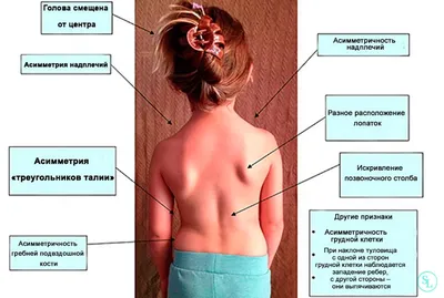Новые упражнения для борьбы с гипертонией - Российская газета