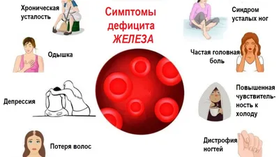 Антоновский мост устал. И другие приколы - Новости на KP.UA