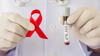 Диагностика ВИЧ-инфекции: почему так важна - врачи, отзывы, записаться на  прием в Москве