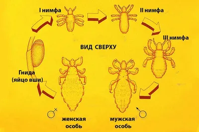 Уничтожение вшей в Алматы | СЭС (дезинсекция)