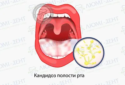 Курение и здоровье зубов - Блог компании Revyline